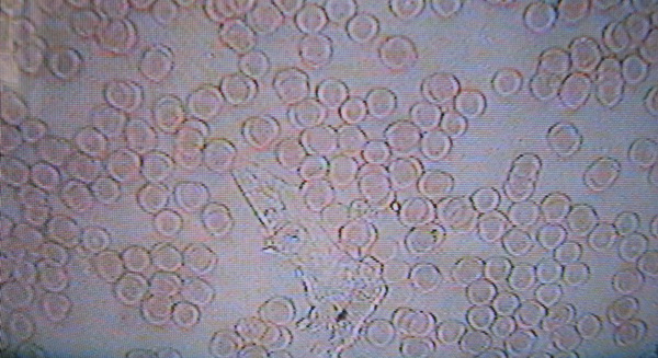 b_kancerogen.jpg b_kancerogen.jpg